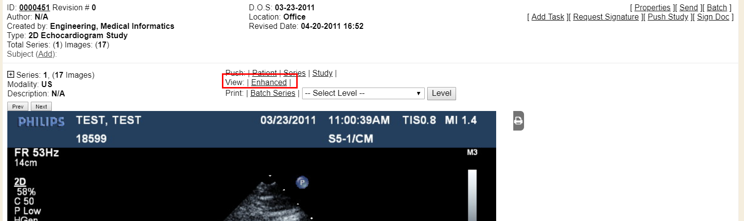 45a7664b86f83b4c11f7a1a14768c9c7